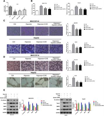 COE targets EphA2 to inhibit vasculogenic mimicry formation induced by hypoxia in hepatocellular carcinoma